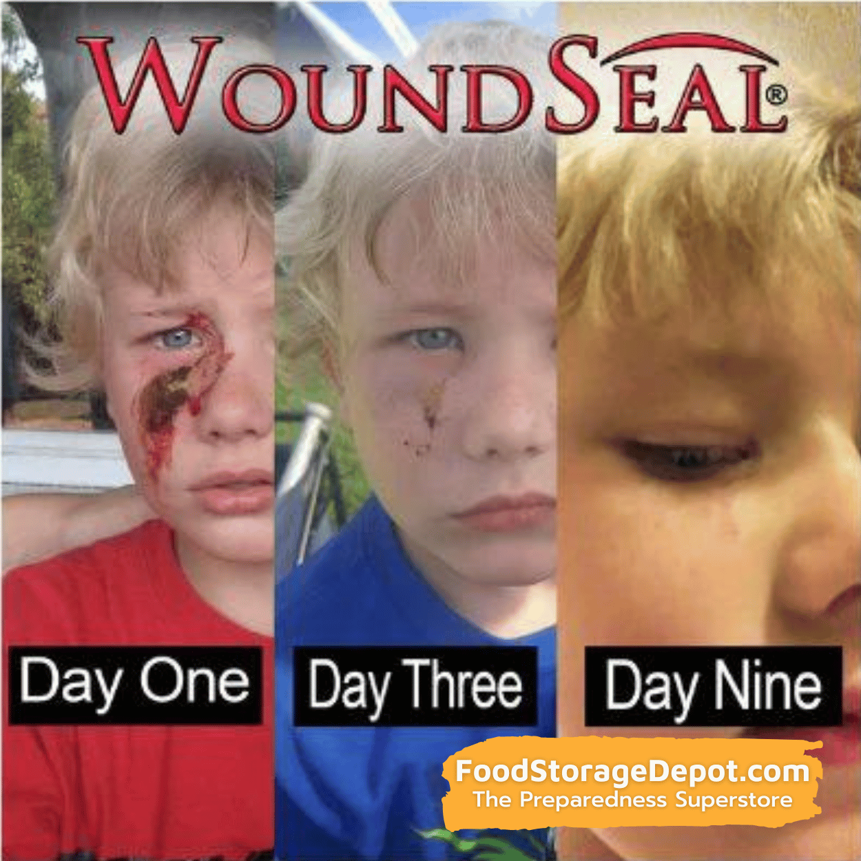 Wound Seal - 4 Applicators